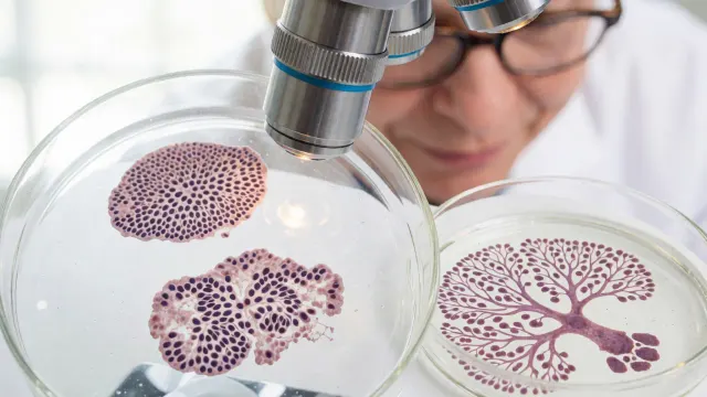 Dietary supplement may influence lung tumor growth differently in females and males